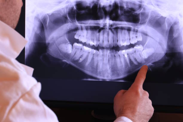 Best Emergency Denture Repair in Lonsdale, MN