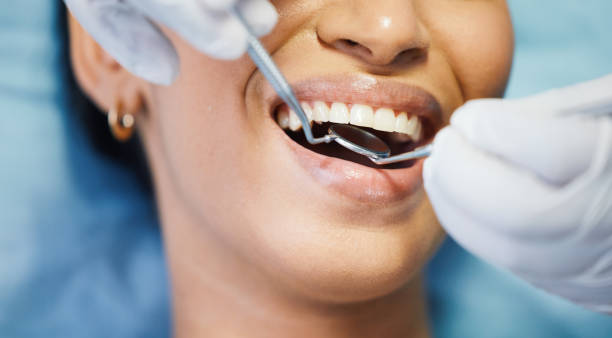 Best Broken or Chipped Tooth Repair in Lonsdale, MN