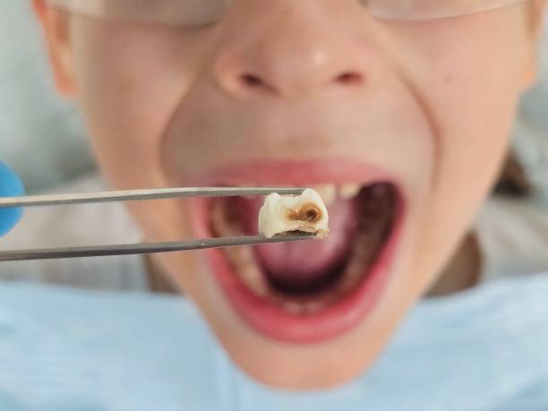 Best Emergency Care for Gum Disease in Lonsdale, MN